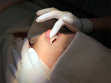 歯肉マッサージ